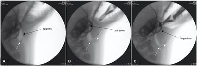 Videofluoroscopy of the aerodigestive tract in Phoca vitulina: reshaping perspectives on translational medicine